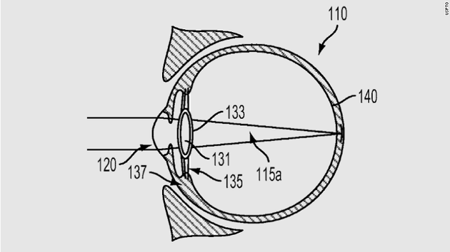 谷歌新专利用电子眼替换晶状体：能矫正近视眼还能拍照 